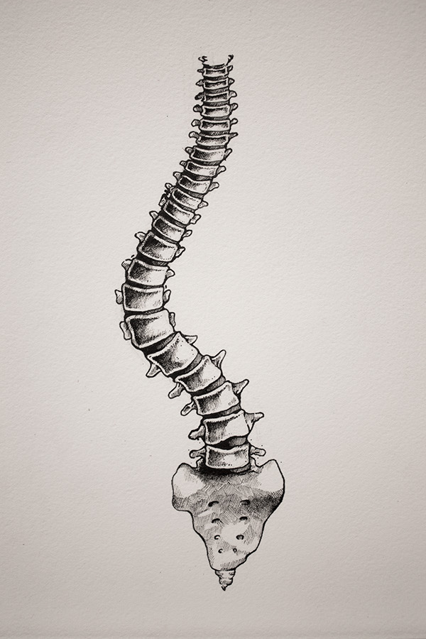 Scoliosis Drawing at Explore collection of