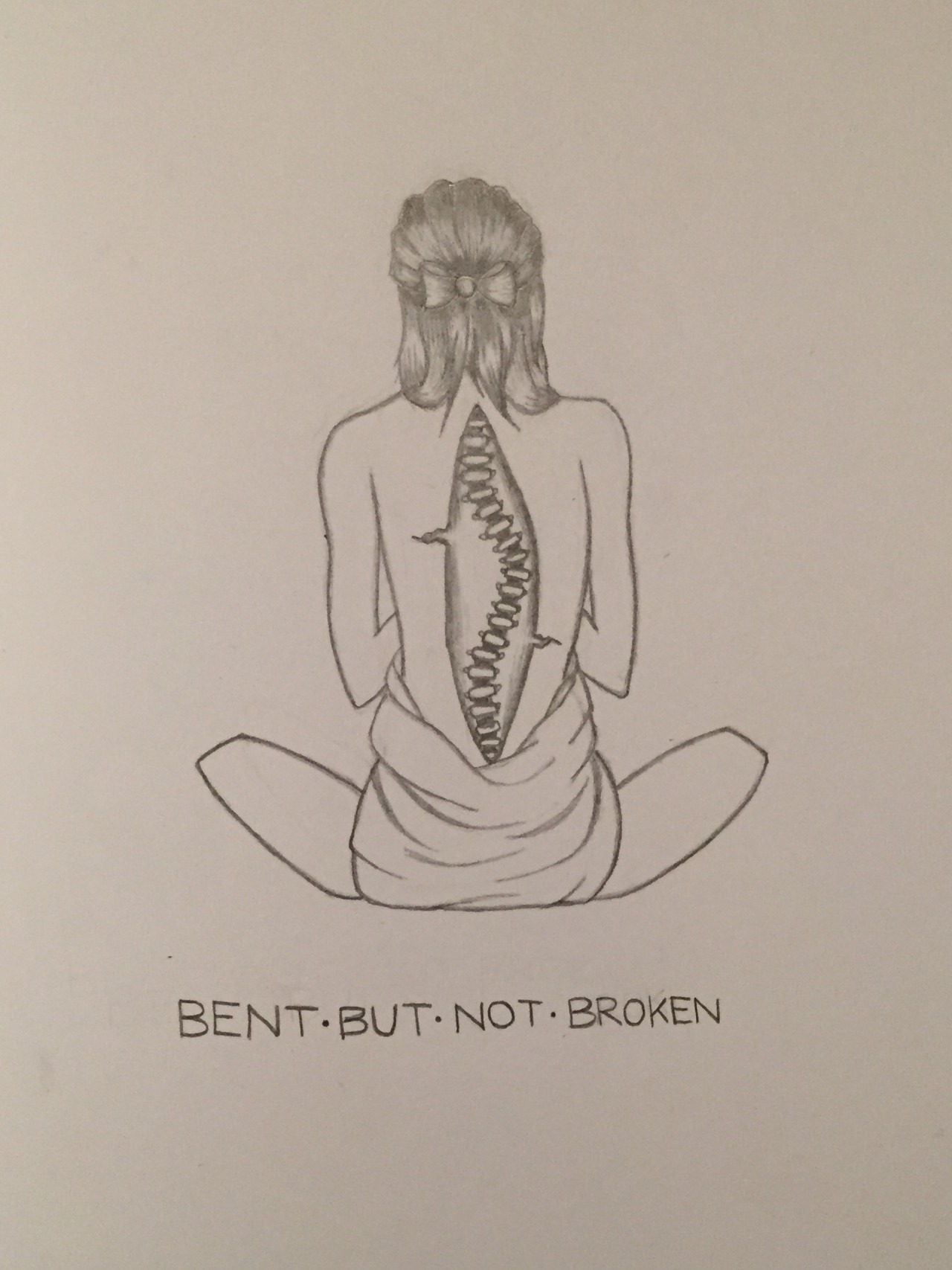 1280x1707 we're broken people i finished my latest drawing!!! to everyone - Scoliosis Drawing