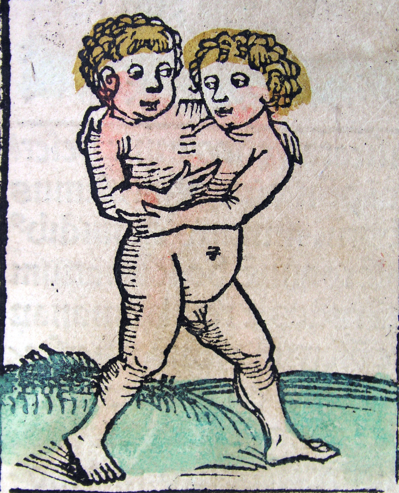 1350x1668 Filenuremberg Chronicles - Siamese Twins Drawing