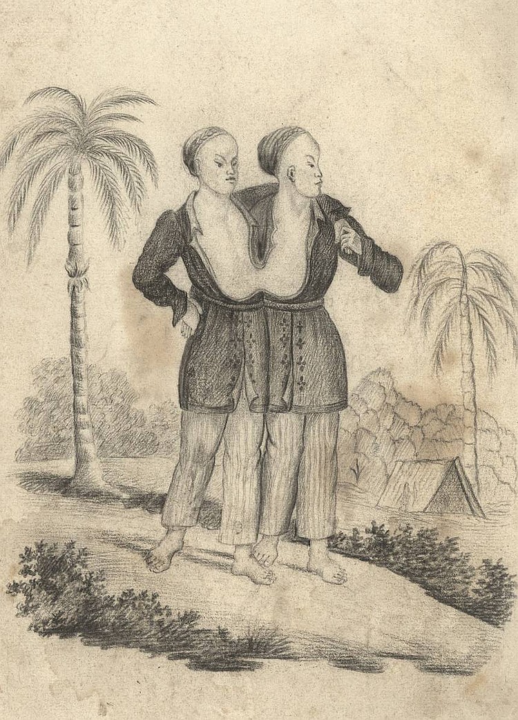 750x1043 Anonymous - Siamese Twins Drawing