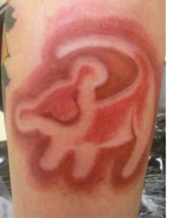 602x720 Pictures Of Simba Drawing On Tree Tattoo - Simba Drawing On Tree