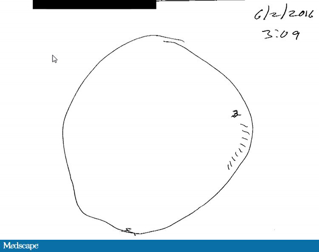 650x514 In Search Of Lost Time The Clock Test - Simple Clock Drawing