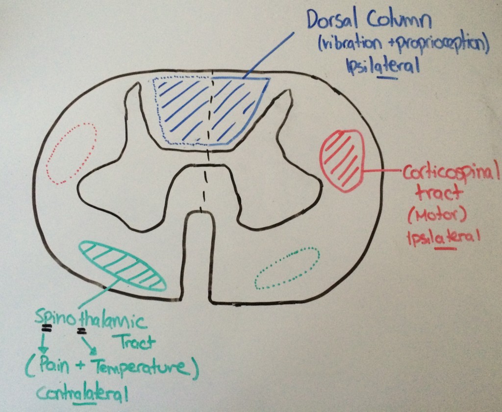 1024x841 a boring guide to spinal cord syndromes - Simple Spine Drawing
