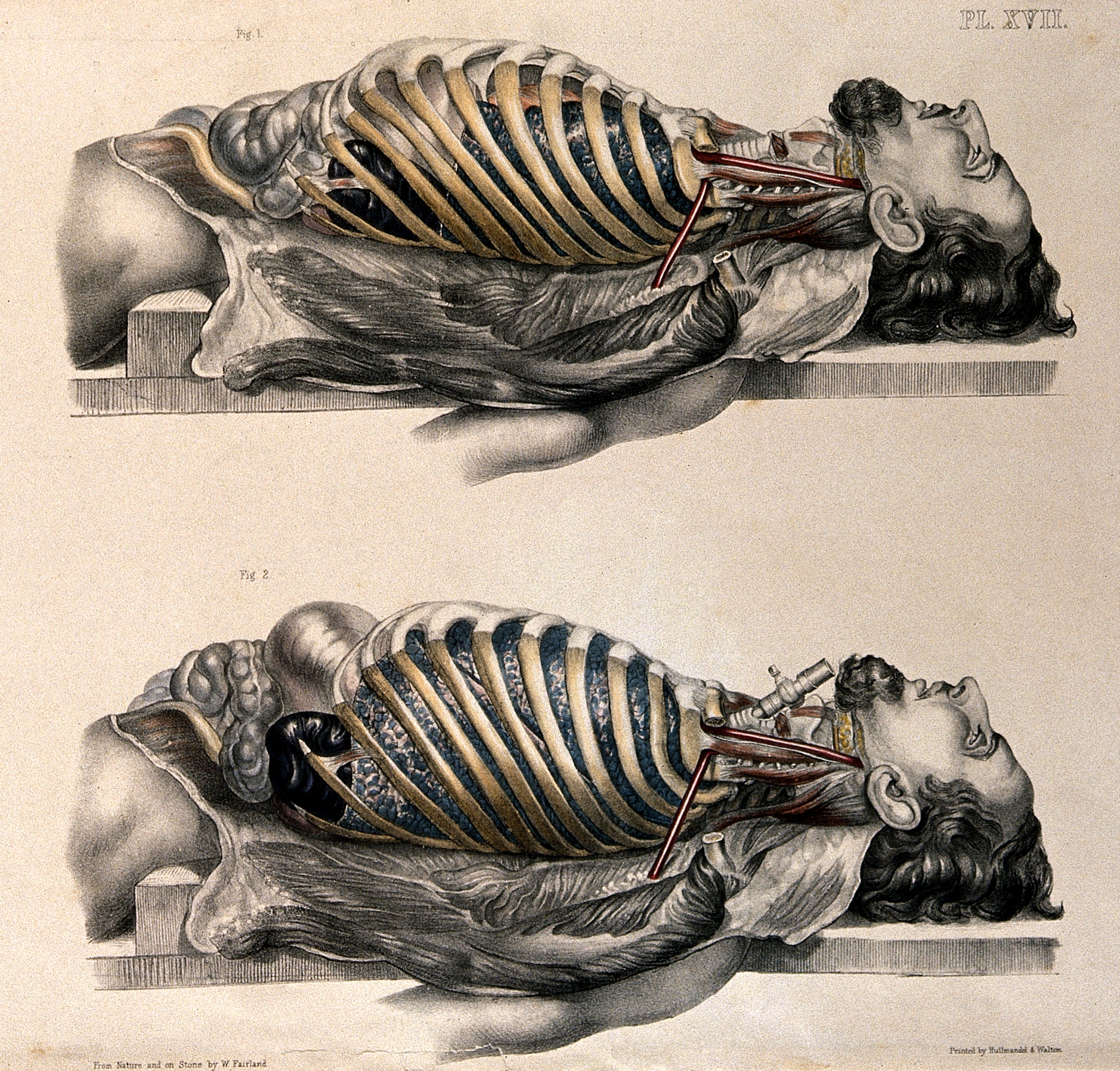 2750x2630 filethe body of a man lying down wellcome - Skeleton Lying Down Drawing
