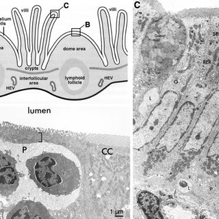 320x320 the small intestine - Small Intestine Drawing