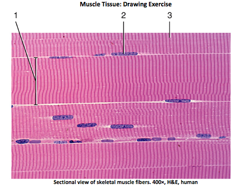 472x377 solved muscle tissue drawing exercise sectional view - Smooth Muscle Drawing