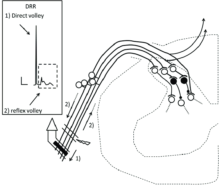 721x609 schematic drawing of a segment of the spinal cord - Spinal Cord Drawing