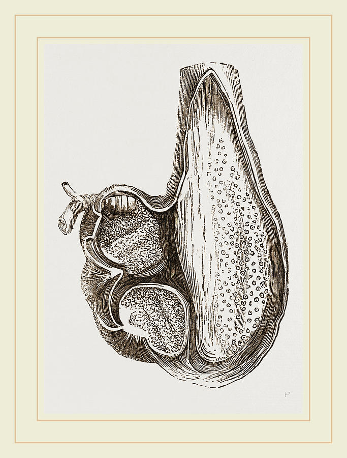683x900 stomach of ostrich laid open drawing - Stomach Drawing