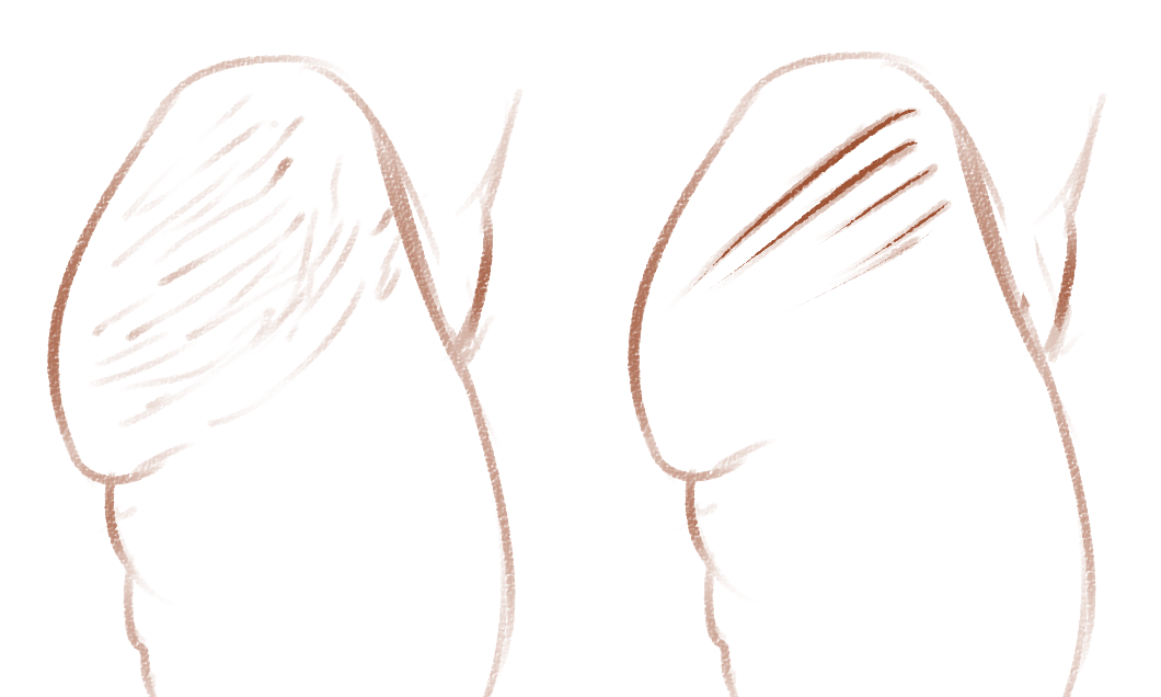 1060x636 For Your Reference You Draw Stretch Marks Beautifully, And I - Stretch Drawing