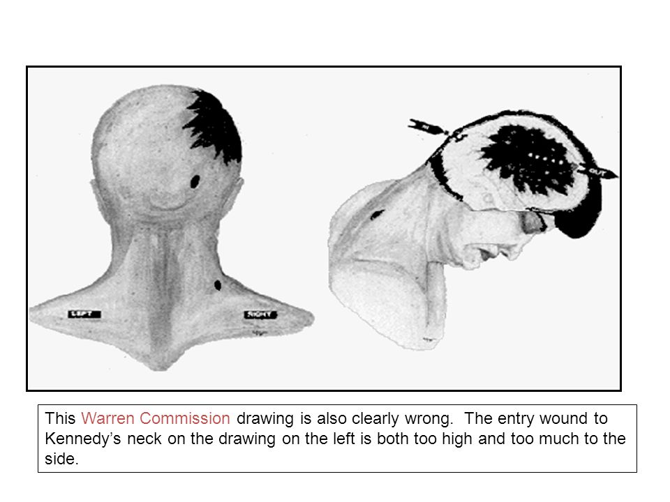 960x720 lee harvey oswald texas book depository shots - Throat Drawing