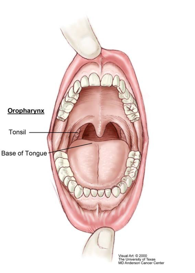 387x540 Oropharyngeal Cancer And The Human Papillomavirus - Throat Drawing
