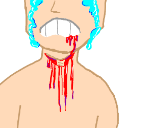 300x250 Sore Throat Cut Drawing - Throat Drawing