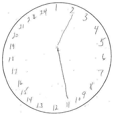 459x467 Home Based Assessment Tool For Dementia Screening - Time Clock Drawing