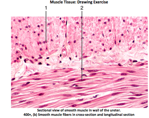 479x379 solved muscle tissue drawing exercise sectional view - Tissue Drawing