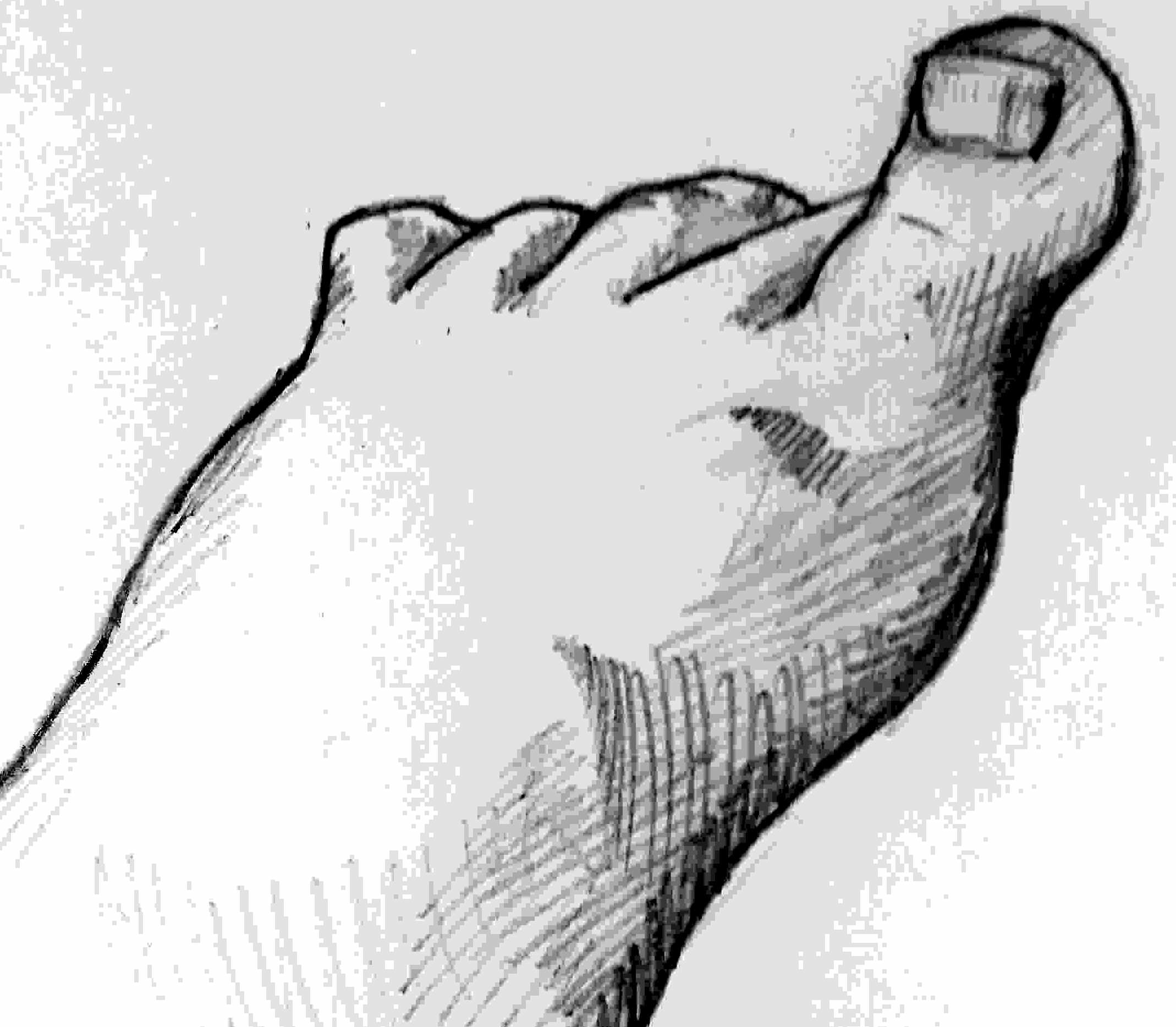 2138x1867 tight boots and foot dystonia blogging with parkinson - Toe Drawing