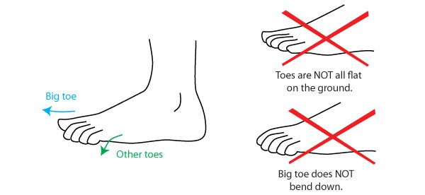 600x276 Details Of The Toes Art Human Anatomy, Drawings, Anatomy - Toe Drawing