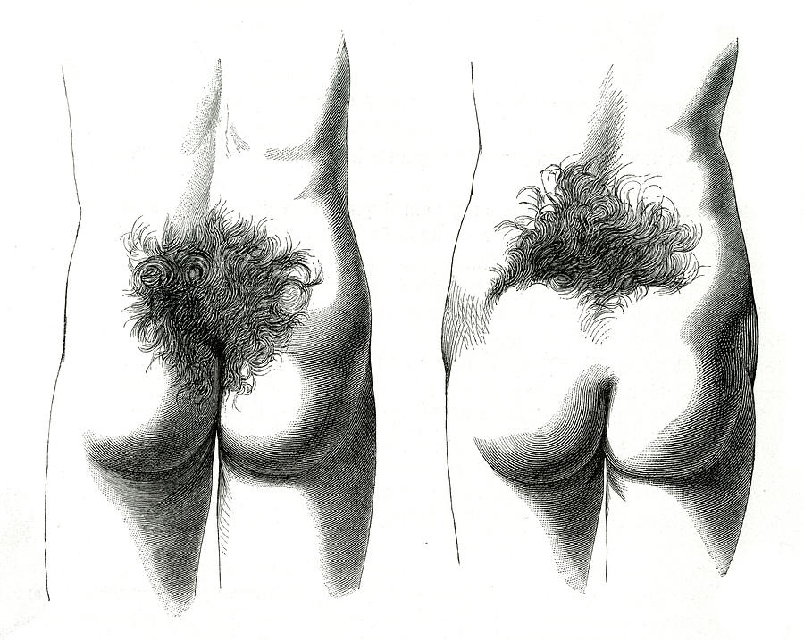 900x717 Two People With Abnormal Growths Drawing - Two People Drawing