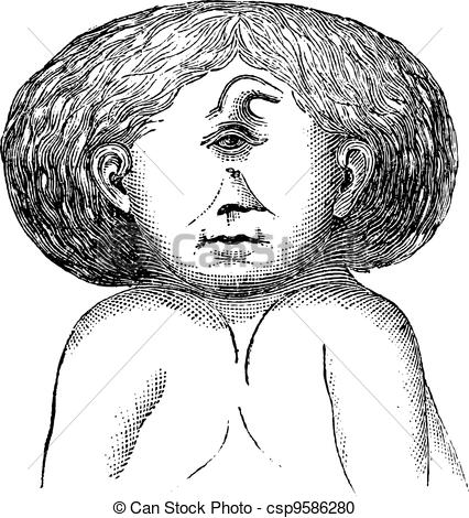 426x470 fig one head and two bodies conjoined twin, vintage - Two Pictures In One Drawing