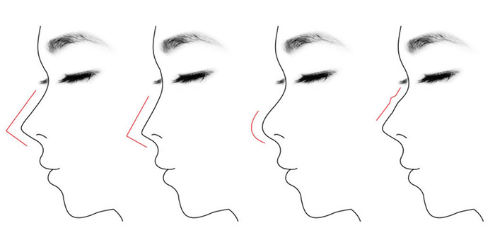 Types Of Noses Drawing at PaintingValley.com | Explore collection of ...