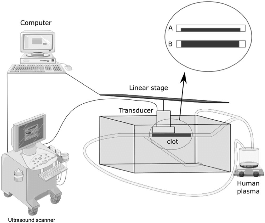 Ultrasound Drawing at Explore collection of