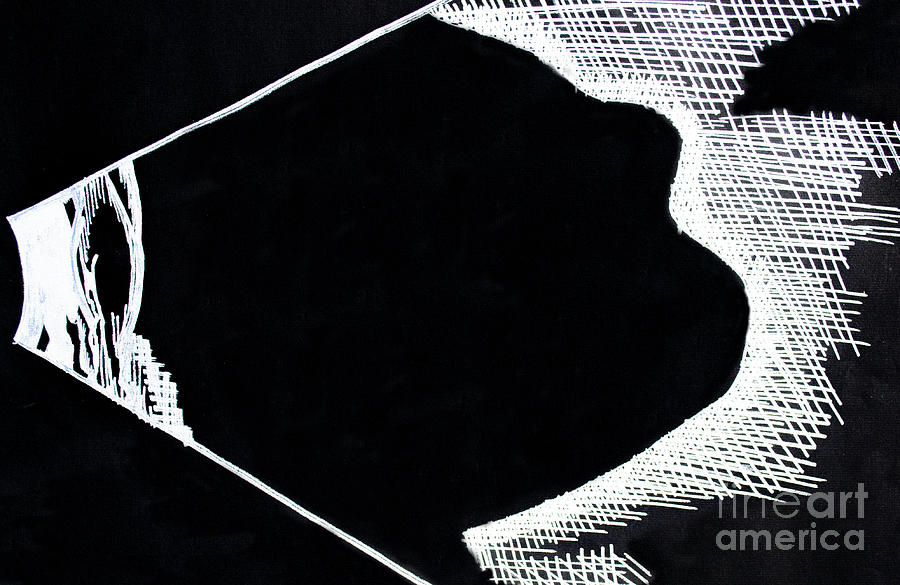 900x585 Straphyloma Ultrasound Drawing - Ultrasound Drawing