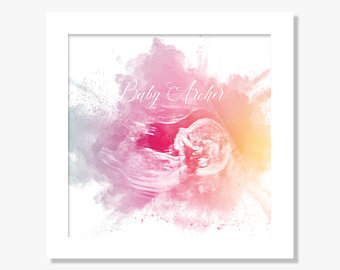 340x270 Ultrasound Art Etsy - Ultrasound Drawing