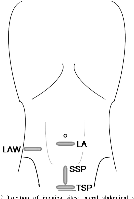 Ultrasound Drawing at Explore collection of