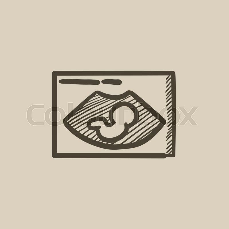 800x800 fetal ultrasound vector sketch icon stock vector colourbox - Ultrasound Drawing