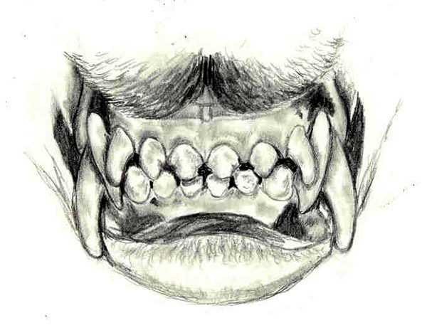 600x464 drawn teeth vampire - Vampire Teeth Drawing