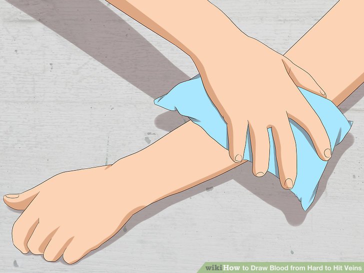 728x546 how to draw blood from hard to hit veins steps - Veins Drawing
