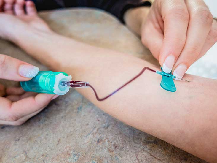 732x549 Butterfly Needle For Blood Draw How It Works And Why It's Used - Veins Drawing