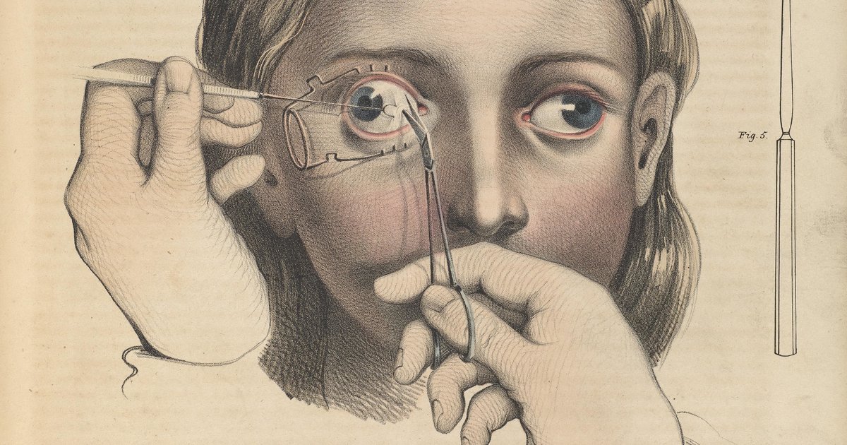 1200x630 These Grisly Victorian Medical Drawings Will Horrify You - Victorian Drawings