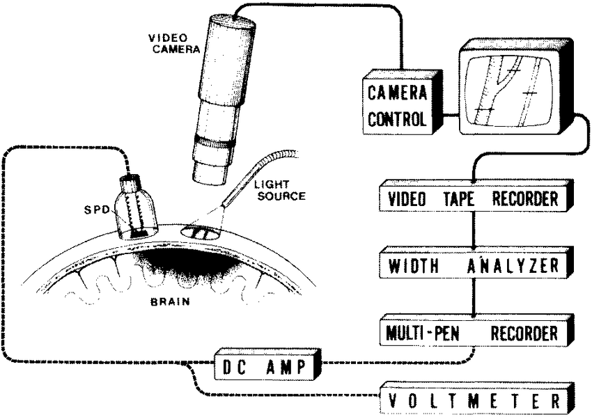 850x599 schematic drawing of the video camera photoelec tric system spd - Video Camera Drawing
