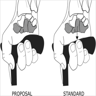 309x309 design and evaluation of the walking cane handle grip taniguchi - Walking Cane Drawing