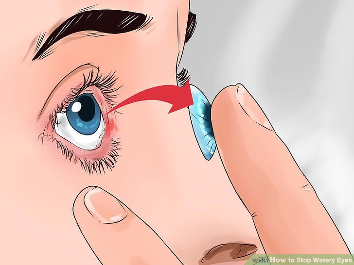 728x546 the best way to stop watery eyes - Watery Eyes Drawing