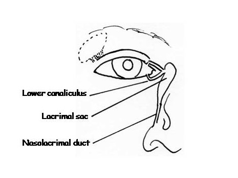 465x347 watery eyes - Watery Eyes Drawing