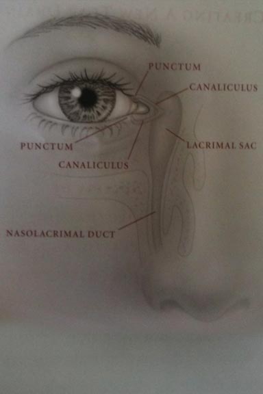 384x576 dcr external, dcr endoscopic eye surgery, tear duct surgery - Watery Eyes Drawing