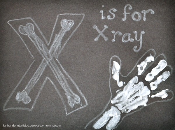 600x446 skeleton and x ray crafts for kids - X Ray Drawing Kindergarten