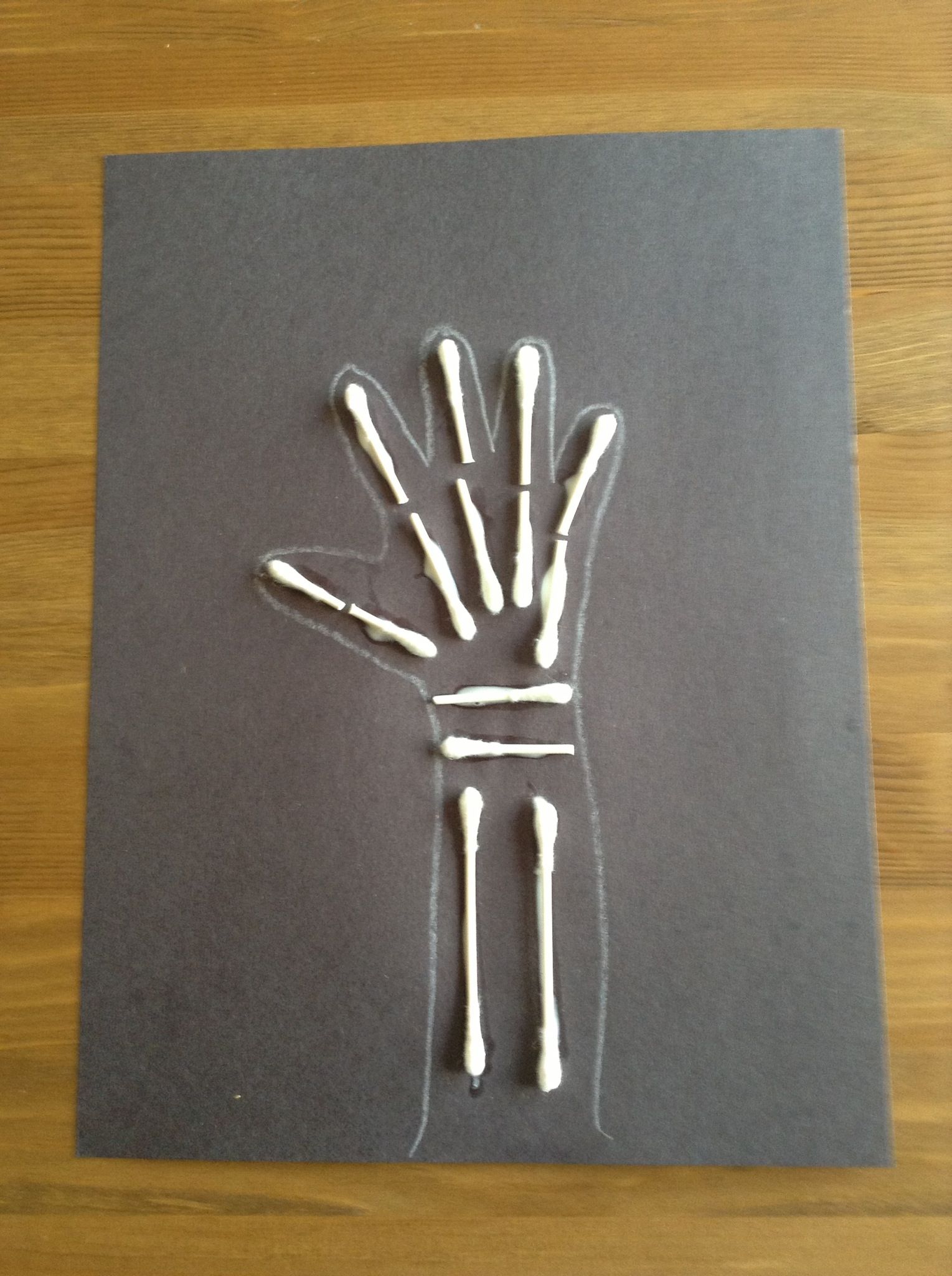 1529x2048 x is for x ray craft - X Ray Drawing Kindergarten