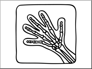 304x229 clip art basic words x ray bampw unlabeled i abcteach - X Ray Drawing Kindergarten