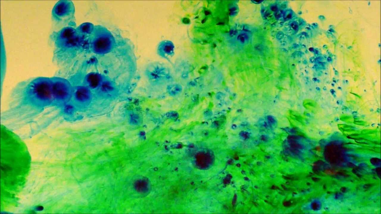 1280x720 Tree - Trippy Watercolor