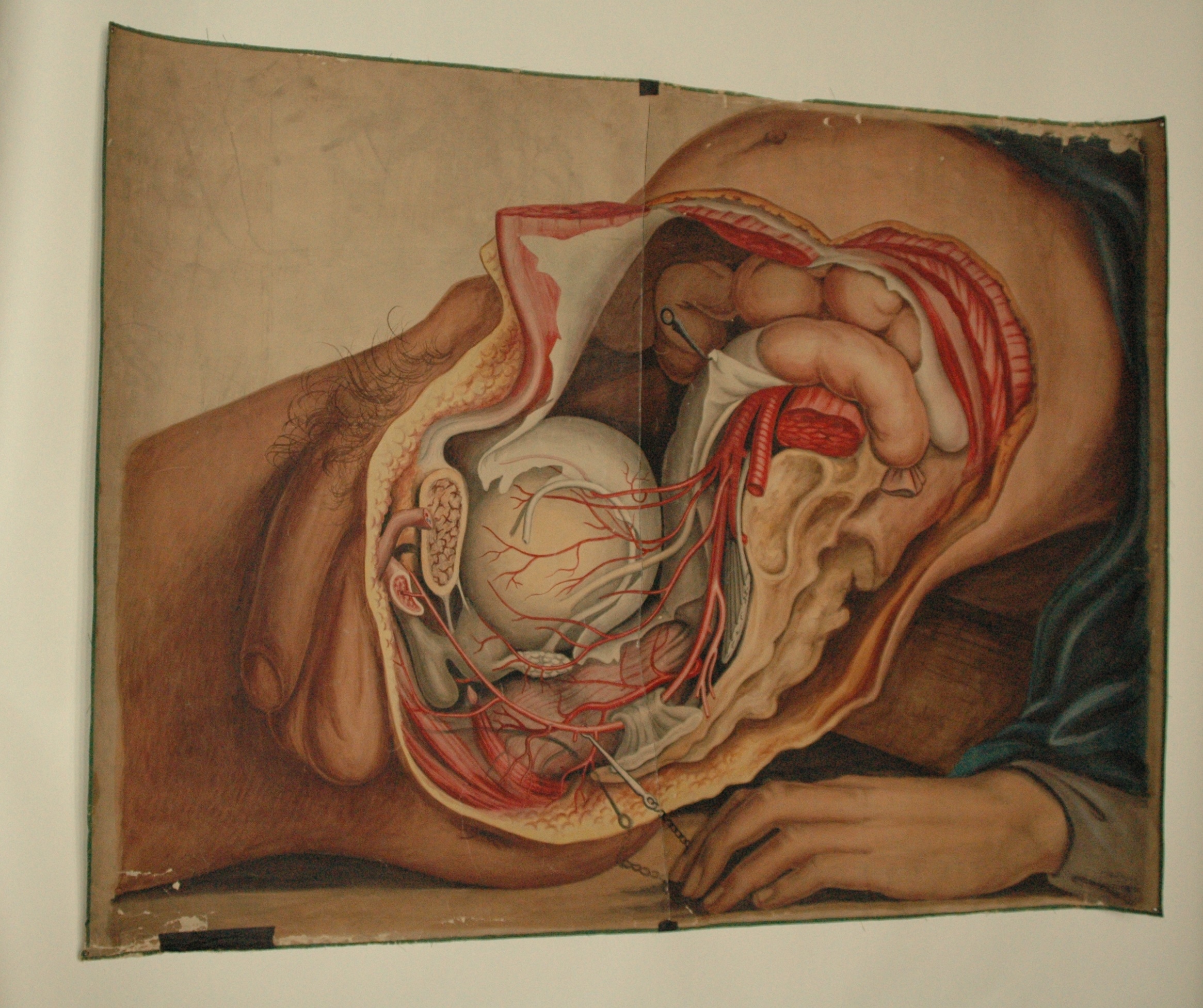 2331x1953 Teaching Watercolor Of Pelvic Organs And Arteries Of The Male Body - Watercolor Human Body