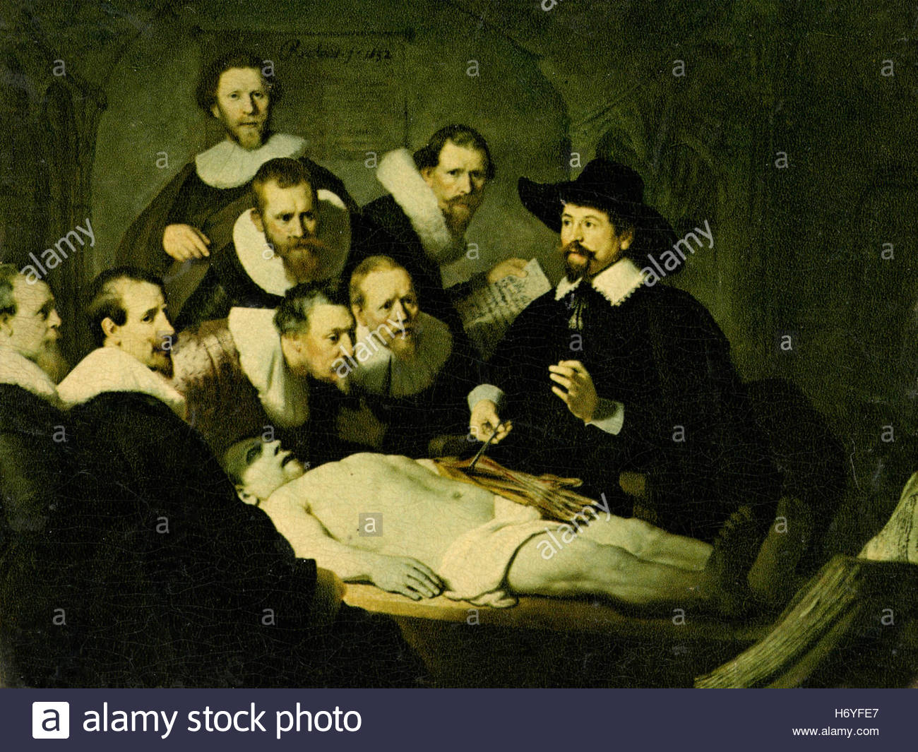 1300x1065 Anatomy Lesson, Rembrandt Painting Stock Photo 124765375 - Anatomy Painting