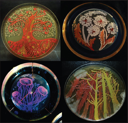 422x406 Painting With Bacteria Hajar R - Bacteria Painting
