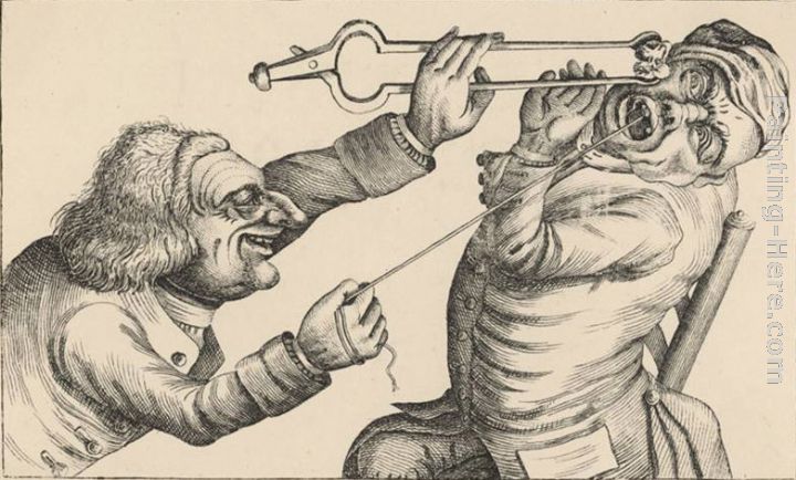 720x434 John Collier Drawing A Tooth With The Help Of A Hot Coal Painting - Coal Painting