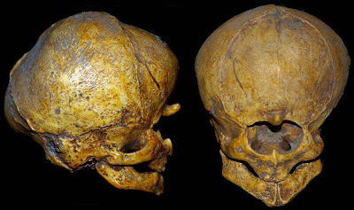 400x237 Enlightened Words The Cyclops Of Odilon Redon - Cyclops Painting