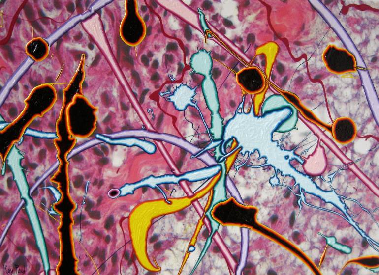 770x560 Saatchi Art Dendritic Swarm Painting By Ray Paul - Dendritic Painting