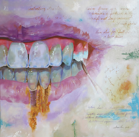 471x465 Lmtmag Artists In Residence Painting A Picture Of Dental Technology - Dental Painting