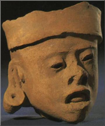 360x434 Down Syndrome Through The Centuries In Art Hektoen International - Down Syndrome Painting