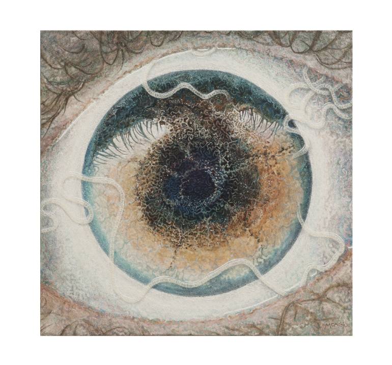 770x717 Saatchi Art Hell Loa Loa (My Journey With The African Eye Worm - Eyeball Painting